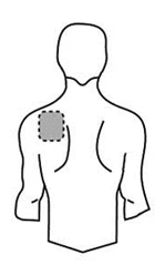 Schematic drawing of a male torso viewed from the back, with a dashed gray circle indicating the application site on the left shoulder