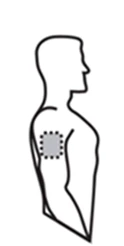 Stylized profile drawing of a man with a dashed gray circle positioned on the upper right arm