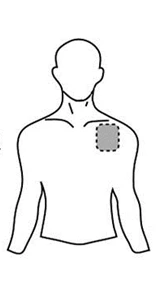 Schematic drawing of a male torso showing a dashed circle indicating the placement of a patch on the upper left chest