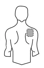 Schematic drawing of a human torso viewed from the back with a dashed gray circle positioned on the upper right shoulder
