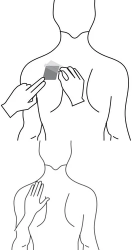Schematic drawing of a human torso showing two hands applying a patch to the chest and one hand touching the upper back