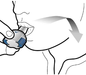 Schematic drawing of a person holding a medical device between the lips with an arrow indicating inward movement