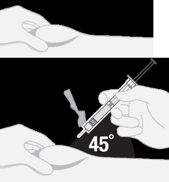 Una mano levanta el pliegue cutáneo del brazo mientras la