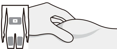 Diagrama médico que muestra una mano que pellizca la piel del