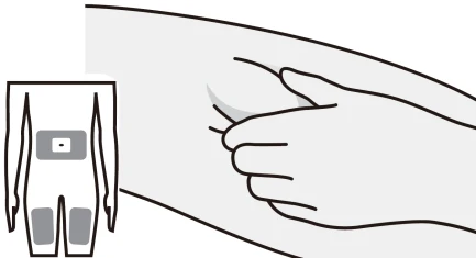 Diagrama médico que muestra una mano que pellizca la piel del muslo y un cuerpo humano con áreas resaltadas en el abdomen y los muslos