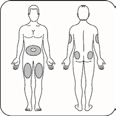 Diagramma del corpo umano frontale e posteriore con zone grigie che indicano i siti di iniezione sull'addome, sulle cosce e sui glutei