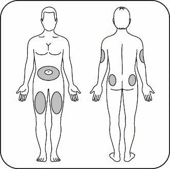 Disegno schematico di un corpo umano visto di fronte e di spalle con zone grigie che indicano i siti di iniezione su addome, cosce, braccia e glutei