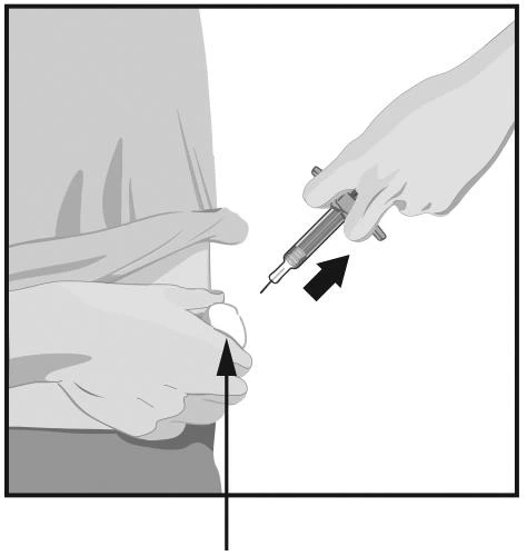 Una mano tiene una siringa pronta per l'iniezione mentre l'altra mano sostiene la pelle del paziente con due dita per tendere la zona