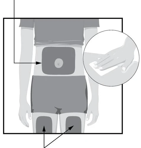 Diagramma che mostra l'applicazione di un cerotto sull'addome e le zone di iniezione sulle cosce di una figura umana stilizzata