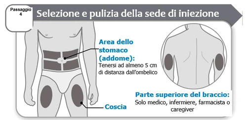 Diagramma medico che indica le zone di iniezione sull'addome lontano dall'ombelico, sulle cosce e sulla parte superiore del braccio