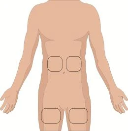 Diagram of the male torso with four rectangular areas outlined on the abdominal region and thighs indicating injection sites