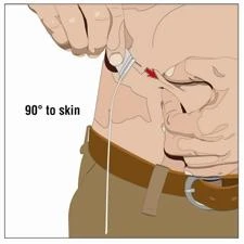 Two hands preparing a