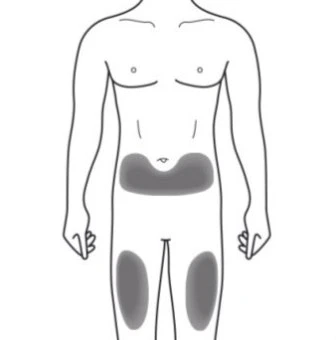 Schematic drawing of a male body with gray areas highlighted on the lower abdomen