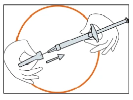 Two hands inserting a medical device into a body cavity