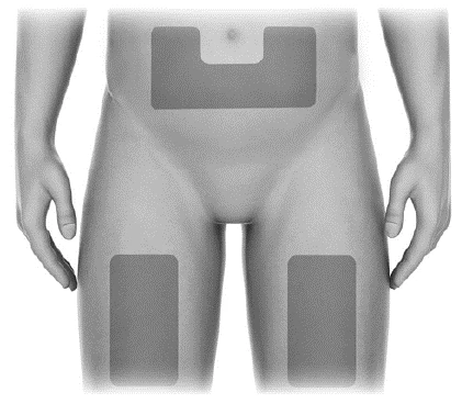 Diagram of a male torso with three rectangular adhesive patches applied on the upper part of the
