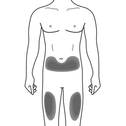 Schematic drawing of a male body with dark gray areas highlighted on the