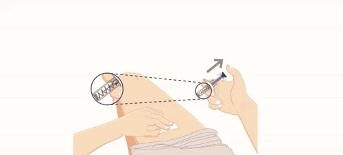 Medical illustration of hands holding a syringe for a