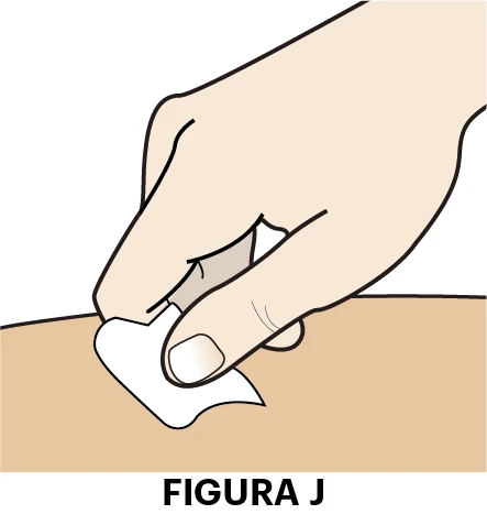 A hand applying a white bandage to a light skin surface with the label 'FIGURE J' at the bottom