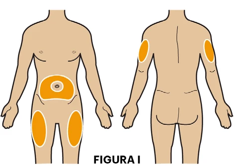 Front and back human body diagram with orange areas indicating injection sites on the