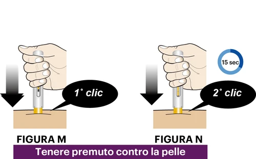 Medical illustration showing two phases of