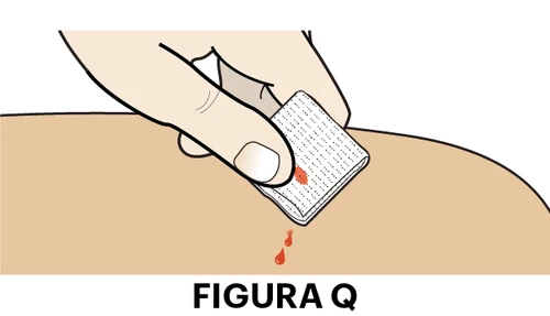 A hand pressing a white gauze pad on a skin wound with drops of blood dripping onto the skin beneath the label 'Figure Q'
