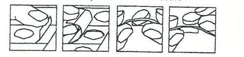 Quattro diagrammi sequenziali che mostrano l'inserimento di un ago tra le cellule di un tessuto biologico in quattro fasi distinte