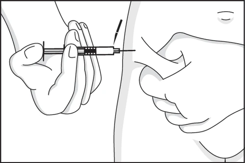Black and white drawing showing a hand holding a syringe injecting liquid into the subcutaneous adipose tissue of the