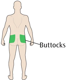 Diagrama del cuerpo humano visto por detrás con las áreas de los glúteos resaltadas en verde y una línea que indica la inscripción Buttocks