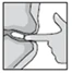 Un dito preme con decisione sulla parte superiore di un dispositivo medico applicato alla pelle del corpo in un diagramma medico in bianco e nero