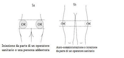 Diagrammi medici che mostrano due zone corrette per l'iniezione sulle cosce e sui fianchi contrassegnate con la scritta OK