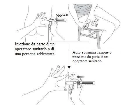 Schema illustrativo che mostra tre modalità di iniezione: da operatore sanitario, auto-somministrazione o iniezione da operatore a 90 gradi