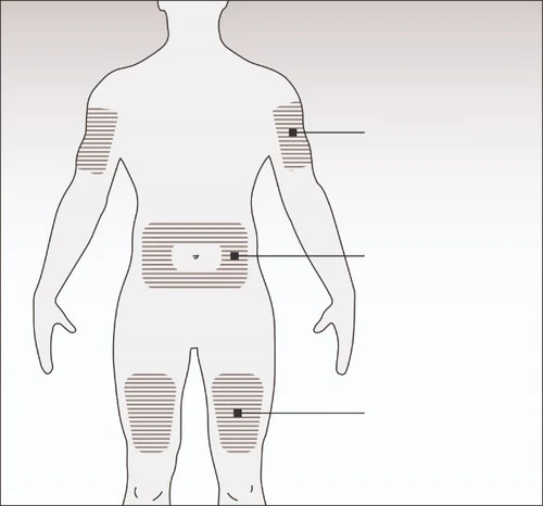Human body diagram viewed from the back with hatched areas on arms, abdomen, and thighs indicating drug injection sites