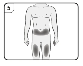 Diagram of the male body with areas