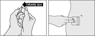 Due disegni mostrano mani che aprono un dispositivo medico tirando una linguetta e una mano che preme il dispositivo contro la pelle