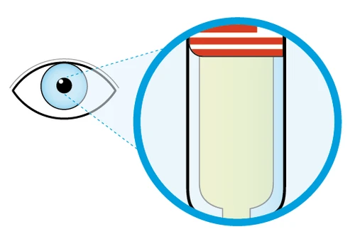 Diagram showing an eye observing a magnified detail of a medical vial with clear liquid and a red upper band