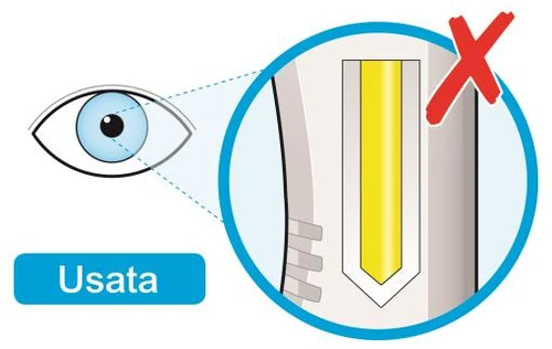 Medical diagram with an eye observing a magnified detail of a device with a central yellow section and a red prohibition cross