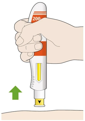 A hand gripping a white and orange medical device with number 200 over a skin surface indicated by a green arrow toward the