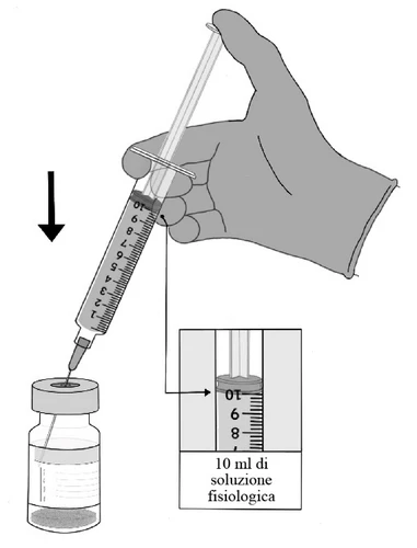 Una mano guantata tiene una siringa per aspirare 10 ml di soluzione fisiologica da un flacone di vetro con un inserto ingrandito del dosaggio