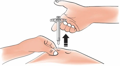 A hand holding a syringe with needle pointing downward while the