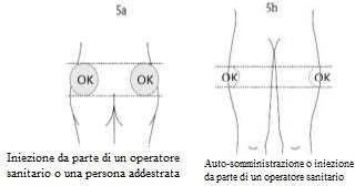 Diagramas médicos 5a y 5b que muestran las zonas correctas para la administración