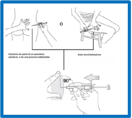 Diagram with three illustrations showing the steps of administration