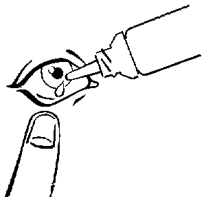 Disegno in bianco e nero di un contagocce che versa una goccia di liquido nell'occhio di una persona con un dito in primo piano