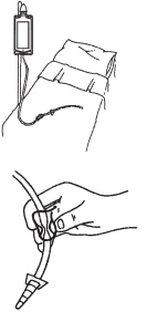 Disegno tecnico di una sacca per infusione collegata a un tubo con una mano che regola una valvola a clip su un flessibile medico