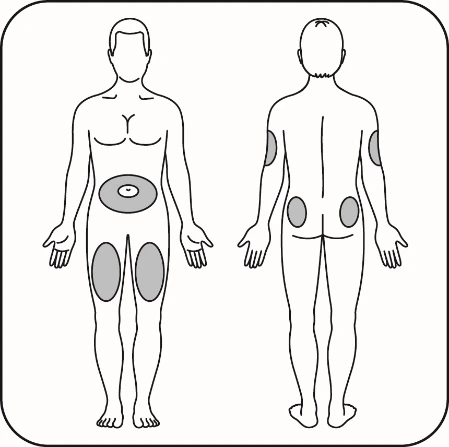 Medical diagram with two human figures, front and back, showing gray areas on abdomen, thighs, hips, and buttocks