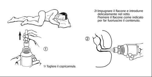 Disegno medico che mostra due passaggi: rimuovere il copricannula dal flacone e inserire il flacone nel retto premendo per far uscire il contenuto