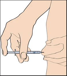 Una mano tiene una siringa orizzontale mentre l'altra pizzica la pelle della coscia per preparare l'iniezione sottocutanea