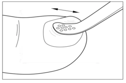 Disegno schematico di un dispositivo medico che viene fatto scorrere avanti e indietro sulla superficie della pelle per l'applicazione