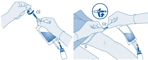 Diagrama médico que muestra dos fases: girar la jeringa para conectarla a la bolsa y luego girar la conexión en el brazo del paciente