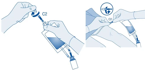 Ilustración médica que muestra dos manos girando una jeringa para conectarla a una bolsa de solución mediante un conector etiquetado C2
