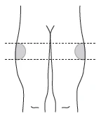 Schematic diagram of the human body showing two circular gray areas located on the hips, delimited by two horizontal dashed lines
